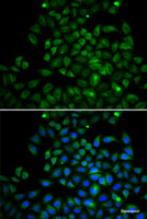 Immunofluorescence analysis of A549 cells using FABP4 Polyclonal Antibody