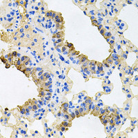 Immunohistochemistry of paraffin-embedded Mouse lung using IGF1R Polyclonal Antibody at dilution of 1:100 (40x lens) .