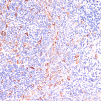 Immunohistochemistry of paraffin-embedded Rat spleen using IKBKE Polyclonal Antibody at dilution of 1:200 (40x lens) .