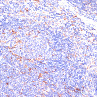 Immunohistochemistry of paraffin-embedded Mouse spleen using IKBKE Polyclonal Antibody at dilution of 1:200 (40x lens) .