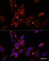 Immunofluorescence analysis of NIH/3T3 cells using IKBKE Polyclonal Antibody at dilution of 1:100. Blue: DAPI for nuclear staining.