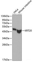 Western blot analysis of extracts of various cell lines using KRT20 Polyclonal Antibody.