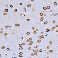 Immunohistochemistry of paraffin-embedded Rat brain using Lamin A/C Polyclonal Antibody at dilution of 1:200 (40x lens) .