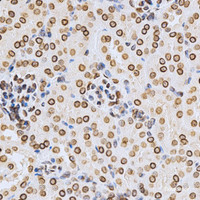 Immunohistochemistry of paraffin-embedded Mouse kidney using Lamin A/C Polyclonal Antibody at dilution of 1:200 (40x lens) .
