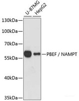 Western blot analysis of extracts of various cell lines using PBEF / NAMPT Polyclonal Antibody at dilution of 1:1000.