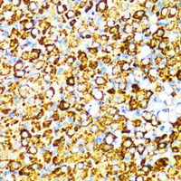 Immunohistochemistry of paraffin-embedded Rat ovary using PBEF / NAMPT Polyclonal Antibody at dilution of 1:100 (40x lens) .