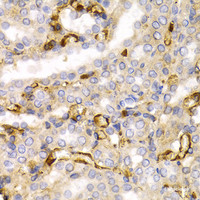 Immunohistochemistry of paraffin-embedded Rat kidney using NEFL Polyclonal Antibody at dilution of 1:200 (40x lens) .