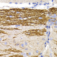 Immunohistochemistry of paraffin-embedded Rat brain using NEFL Polyclonal Antibody at dilution of 1:200 (40x lens) .