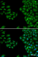 Immunofluorescence analysis of HeLa cells using NEFL Polyclonal Antibody