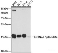Western blot analysis of extracts of various cell lines using CDKN2A / p16INK4a Polyclonal Antibody at dilution of 1:1000.