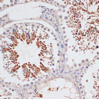 Immunohistochemistry of paraffin-embedded Mouse testis using CDKN2A / p16INK4a Polyclonal Antibody at dilution of 1:100 (40x lens) .