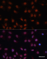 Immunofluorescence analysis of HeLa cells using CDKN2A / p16INK4a Polyclonal Antibody at dilution of 1:100. Blue: DAPI for nuclear staining.