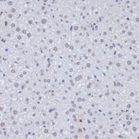 Immunohistochemistry of paraffin-embedded Rat liver using PCNA Polyclonal Antibody at dilution of 1:100 (40x lens) .