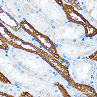 Immunohistochemistry of paraffin-embedded Rat kidney using PIK3CA Polyclonal Antibody at dilution of 1:100 (40x lens) .