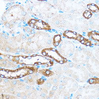 Immunohistochemistry of paraffin-embedded Mouse kidney using PIK3CA Polyclonal Antibody at dilution of 1:100 (40x lens) .