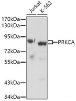 Western blot analysis of extracts of various cell lines using PRKCA Polyclonal Antibody.