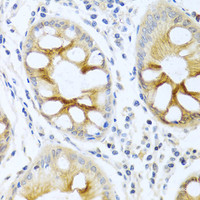 Immunohistochemistry of paraffin-embedded Human colon using PRKCA Polyclonal Antibody at dilution of 1:100 (40x lens) .