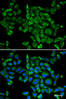 Immunofluorescence analysis of U2OS cells using PRKCA Polyclonal Antibody