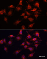 Immunofluorescence analysis of HUVEC cells using VEGFA Polyclonal Antibody at dilution of 1:100 (40x lens) . Blue: DAPI for nuclear staining.