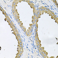 Immunohistochemistry of paraffin-embedded Human prostate using ABL1 Polyclonal Antibody at dilution of 1:100 (40x lens) .