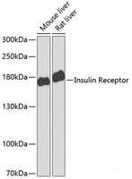 Western blot analysis of extracts of various cell lines using Insulin Receptor Polyclonal Antibody at dilution of 1:1000.