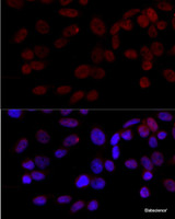 Immunofluorescence analysis of HeLa cells using JNK1 Polyclonal Antibody at dilution of 1:100 (40x lens) . Blue: DAPI for nuclear staining.