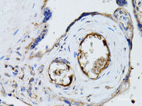 Immunohistochemistry of paraffin-embedded Human placenta using RYR2 Polyclonal Antibody at dilution of 1:100 (40x lens) .