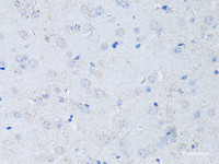 Immunohistochemistry of paraffin-embedded Mouse brain using RYR2 Polyclonal Antibody at dilution of 1:100 (40x lens) .