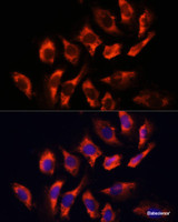 Immunofluorescence analysis of U-2 OS cells using RYR2 Polyclonal Antibody at dilution of 1:100 (40x lens) . Blue: DAPI for nuclear staining.