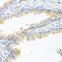 Immunohistochemistry of paraffin-embedded Human prostate using APOE Polyclonal Antibody at dilution of 1:100 (40x lens) .