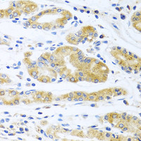 Immunohistochemistry of paraffin-embedded Human stomach using APOE Polyclonal Antibody at dilution of 1:100 (40x lens) .