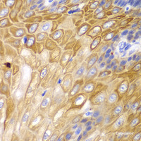 Immunohistochemistry of paraffin-embedded Human esophagus using Cyclin D1 Polyclonal Antibody at dilution of 1:100 (40x lens) .