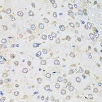 Immunohistochemistry of paraffin-embedded Rat brain using Albumin Polyclonal Antibody at dilution of 1:100 (40x lens) .