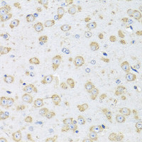 Immunohistochemistry of paraffin-embedded Mouse brain using Albumin Polyclonal Antibody at dilution of 1:100 (40x lens) .