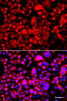 Immunofluorescence analysis of A549 cells using Fatty Acid Synthase Polyclonal Antibody