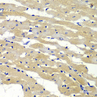 Immunohistochemistry of paraffin-embedded Rat heart using BAK1 Polyclonal Antibody at dilution of 1:100 (40x lens) .