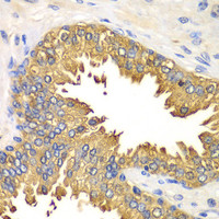 Immunohistochemistry of paraffin-embedded Human prostate using RIG-I / DDX58 Polyclonal Antibody at dilution of 1:100 (40x lens) .