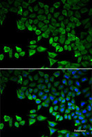 Immunofluorescence analysis of HeLa cells using RIG-I / DDX58 Polyclonal Antibody