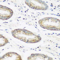 Immunohistochemistry of paraffin-embedded Human gastric using NEDD4 Polyclonal Antibody at dilution of 1:200 (40x lens) .