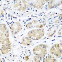 Immunohistochemistry of paraffin-embedded Human stomach using EIF3A Polyclonal Antibody at dilution of 1:100 (40x lens) .