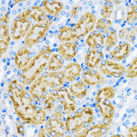 Immunohistochemistry of paraffin-embedded Mouse kidney using EEA1 Polyclonal Antibody at dilution of 1:100 (40x lens) .