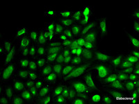 Immunofluorescence analysis of HeLa cells using SPHK1 Polyclonal Antibody