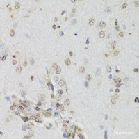 Immunohistochemistry of paraffin-embedded Rat brain using NRF2 Polyclonal Antibody at dilution of 1:100 (40x lens) .