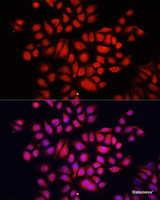 Immunofluorescence analysis of HeLa cells using NRF2 Polyclonal Antibody at dilution of 1:100. Blue: DAPI for nuclear staining.