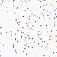 Immunohistochemistry of paraffin-embedded Mouse brain using GATA2 Polyclonal Antibody at dilution of 1:100 (40x lens) .