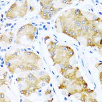 Immunohistochemistry of paraffin-embedded Human stomach using ACVR1C Polyclonal Antibody at dilution of 1:100 (40x lens) .