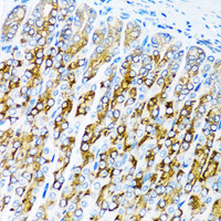 Immunohistochemistry of paraffin-embedded Mouse stomach using ACVR1C Polyclonal Antibody at dilution of 1:100 (40x lens) .