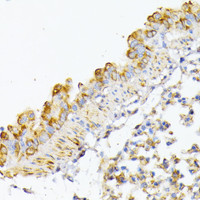 Immunohistochemistry of paraffin-embedded Mouse lung using ATG7 Polyclonal Antibody at dilution of 1:100 (40x lens) .