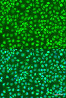 Immunofluorescence analysis of U2OS cells using IKK beta Polyclonal Antibody at dilution of 1:100. Blue: DAPI for nuclear staining.