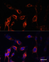 Immunofluorescence analysis of NIH-3T3 cells using TSC1 Polyclonal Antibody at dilution of 1:100 (40x lens) . Blue: DAPI for nuclear staining.